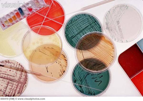 culture of bacteria in petri dish 000419