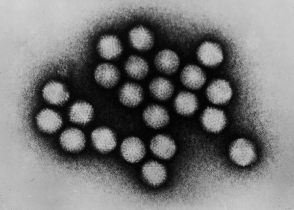 Adenovirus transmission electron micrograph B82 0142 lores