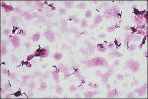 300px Propionibacterium acnes